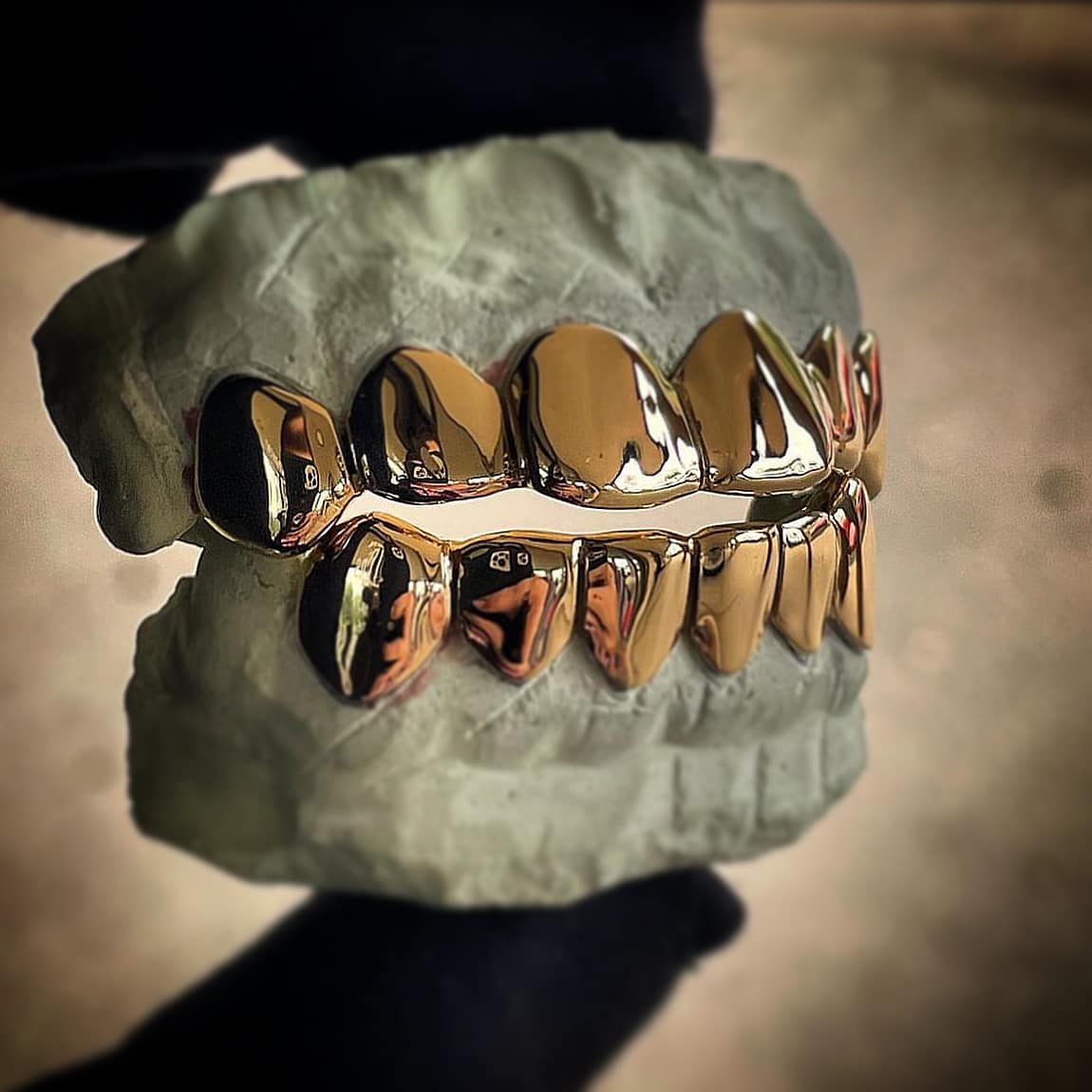 White Gold Grillz